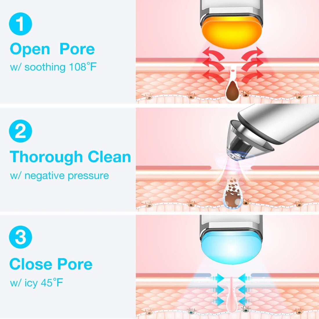 Electric Blackhead Remover